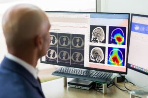 Man looking at computer with brain images